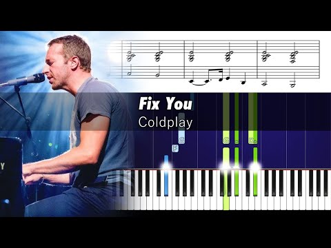 Coldplay - Fix