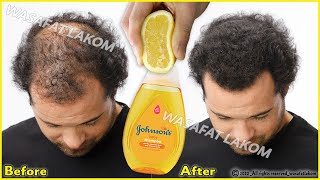 Put these ingredients in your shampoo, it accelerates hair growth and treats baldness
