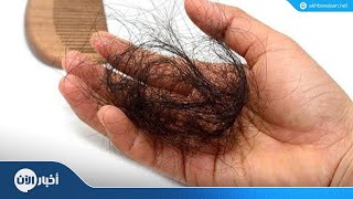 علاج تساقط الشعر مع د. ماهر صالح من مستشفى د. سليمان الحبيب