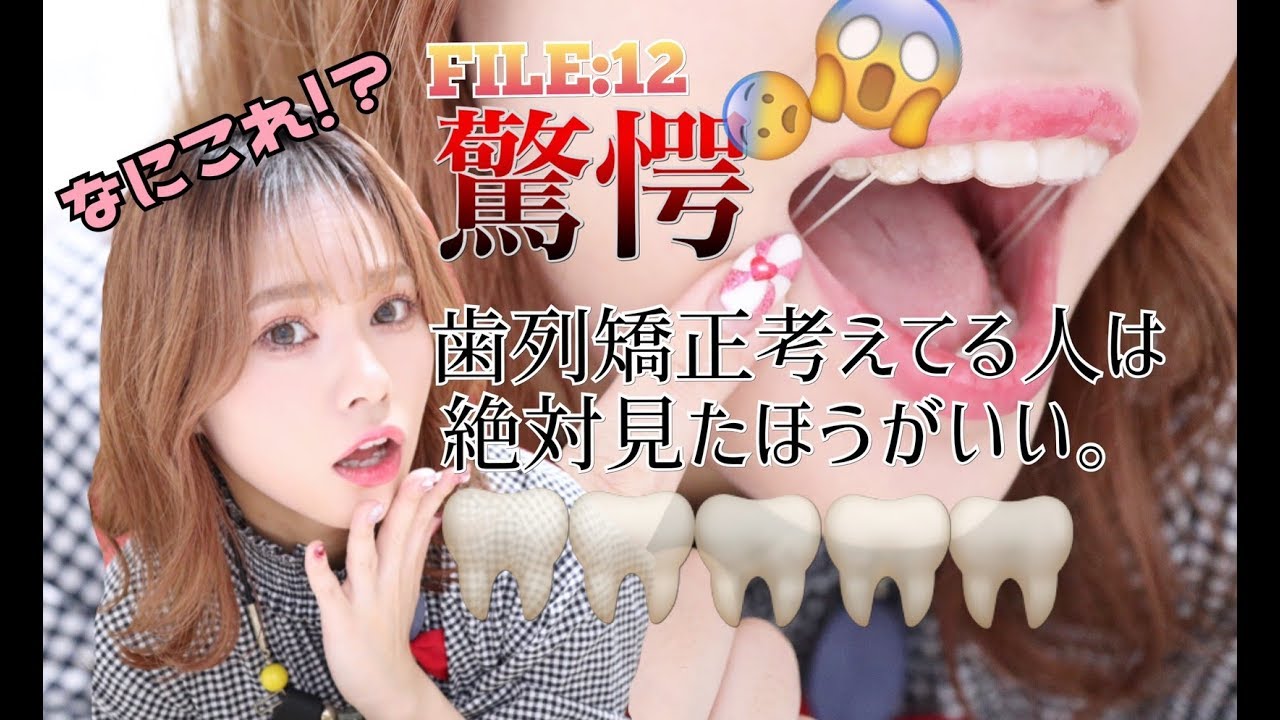 【ゴム掛け】【歯列矯正】え…？思わぬ展開になりました。。【インビザライン】