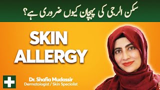 Skin Allergy | Urticaria or Hives | Causes, Symptoms & Treatment | Dr. Shafia Mudassir
