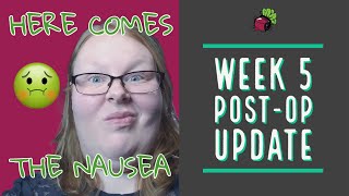 Weight Loss Surgery in Mexico - Week 5 Post-Op Update | My Gastric Bypass Journey