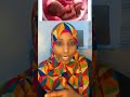 Ilmaha Uurka Ku Meyda Iyo Sida Looga Hortagi Karo Caafimaadnews Somalihealth Hormuud Somalidoctor Ilmaha Uurka Ku Meyda Iyo Sida Looga Hortagi Karo Caafimaadnews Somalihealth Hormuud Somalidoctor