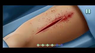 open heart surgery ||doctors game ||  level 1to8 || doctors Android gameplay screenshot 1