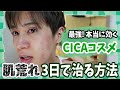 【肌荒れ 3日で治す】最強! 本当に効くおすすめCICAコスメはコレだぁ!!