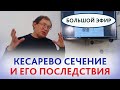 Рубец на матке после кесарева сечения и будущая беременность. Нижнематочный сегмент и его значение.