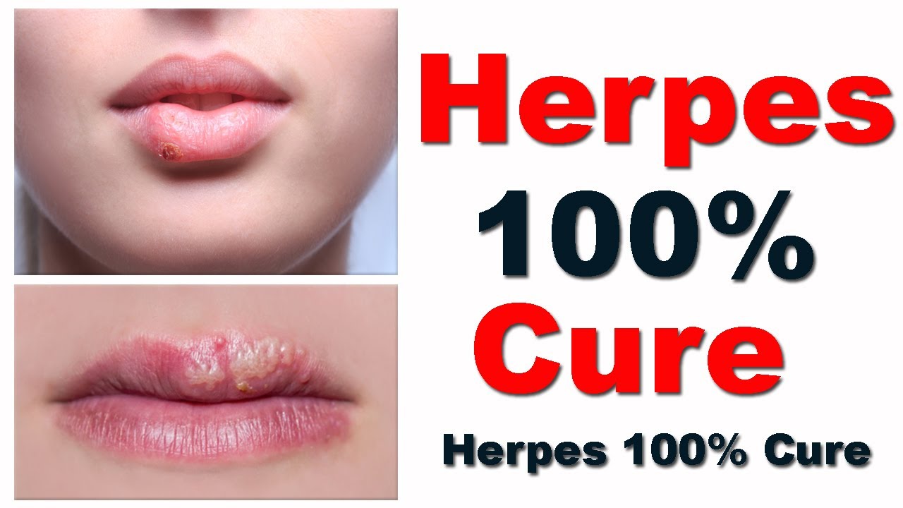 one minute cure herpes review one minute cure herpes review