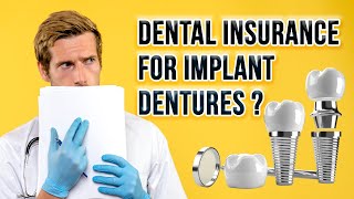 Dental Insurance for Implant Dentures ?📜🦷