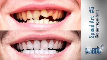 Como arrumar dentes torto no Photoshop?