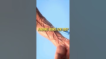 This Device Finds Veins Instantly! 🔥 | Game-Changer for Nurses #medicaltech