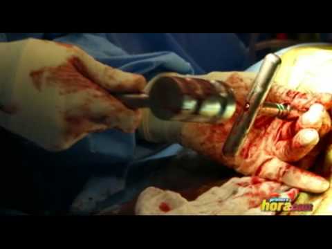 VIDEOS OPERACION videos operacion: