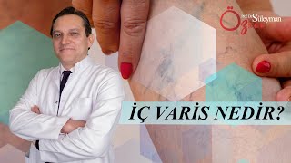 Varis Tedavileri Prof Dr Suleyman Ozkan