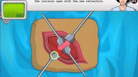 Operate Now! Appendix Surgery - Thats an appendix??