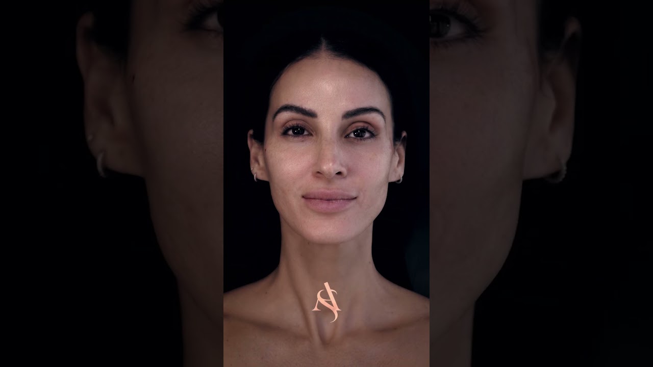 Lip Filler Treatment