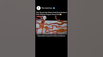 This Thread-Like Robot Could Treat Strokes & Clots Without Surgery 😱 #RoboticSurgery #MedicalTech