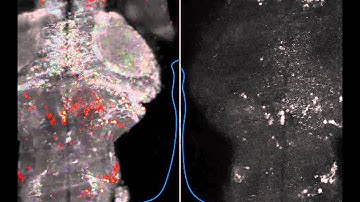 Fast whole-brain imaging made possible for the first time with LSFM - single slice