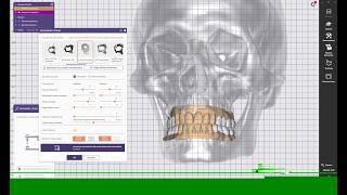 Exocad 3.3 Chemnitz 9512 Injector Version