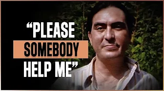 The Tragic Story Of A Man Beaten, Burned, and Abandoned by Authorities