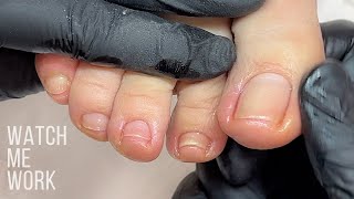Famous Wellness Pedicure: Detailing deep side walls, gentle dry pedi technique [Watch Me Work] Wealth