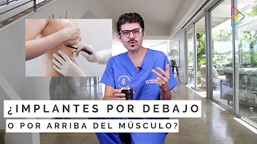 ¿El implante debajo del músculo parece más natural?