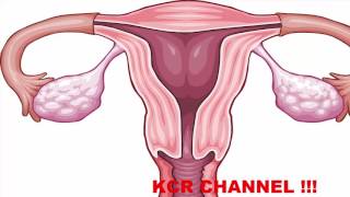 Durante menopausia la musculares dolores
