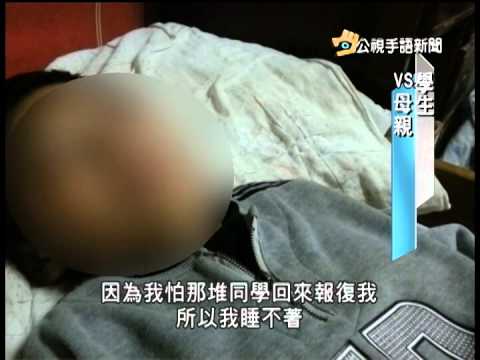 20141209 公視手語新聞 腦傷國中生疑遭霸凌 被丟石砸傷頭