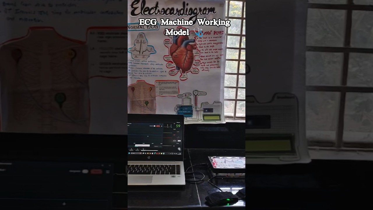 DIY ECG Machine Working Model 🩺 (Biomedical Project) 