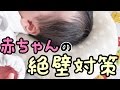 赤ちゃんの頭の絶壁対策！ママ達が実践した方法