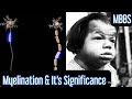 UnMyelinated 🆚 Myelinated Neuron, Why Mental Retardation in Congenital Hypothyroidism? #mbbs #neet