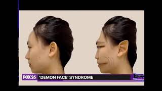 Demon Face Syndrome Hoax trying to prepare for their light bending technology failure by Divine Truth1 1,039 views 2 weeks ago 54 seconds
