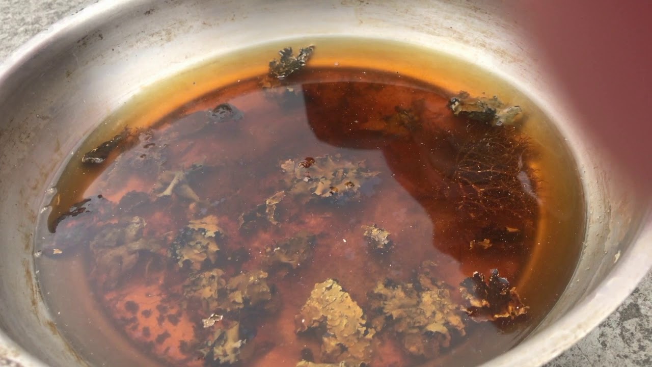 Heart Valve treatment without surgery . दिल के वाल्व का इलाज बीना किसी