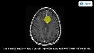 MRI Brain Tumor Segmentation: Expert Annotation Workflow