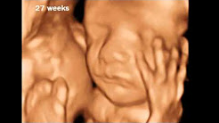 27 Weeks Pregnant - 3D Ultrasound Gallery