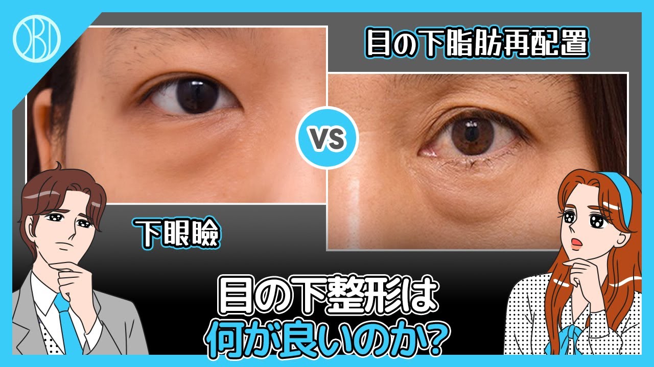 目の下脂肪再配置VS眼瞼下垂VSデュアル眼瞼下垂 似ていながらも違う部分を持つ手術の違いは何か？オブジェ整形外科整形の定石！ジャンウク院長のアドバイスポイント