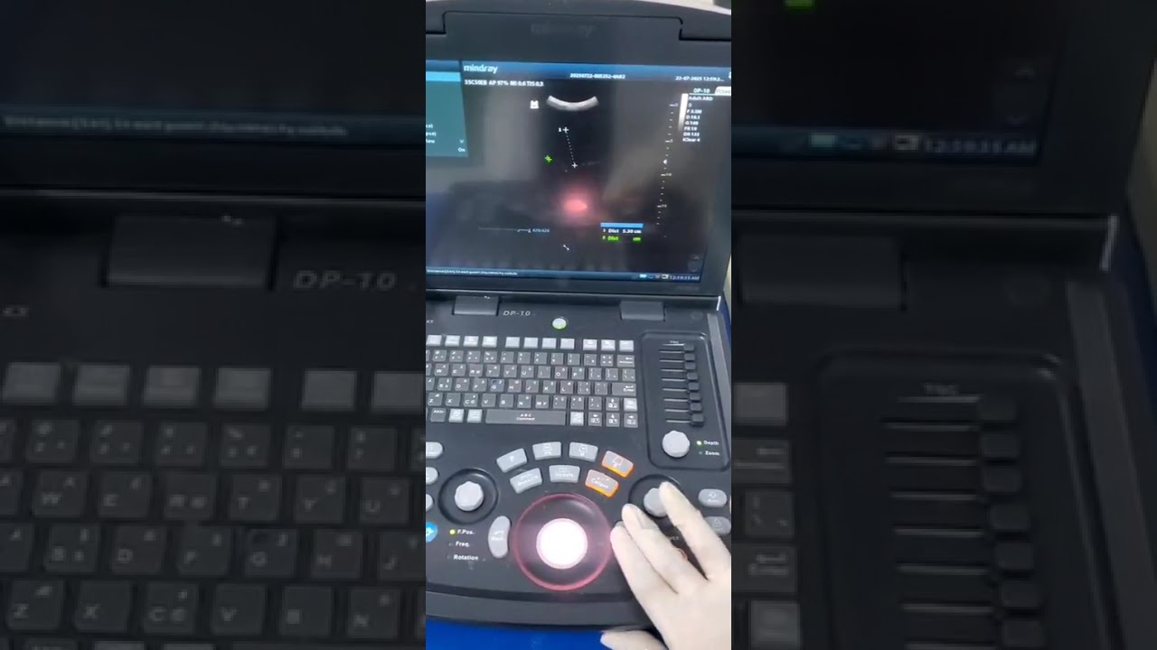 أزرار جهاز السونار الدكتورة .عبير البكري 