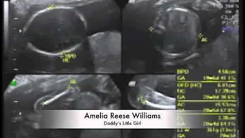 Our First Child - Amelia Reese