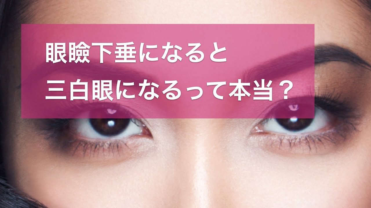 眼瞼下垂中学生: 眼瞼下垂の原因となるのは , 今さら聞けない!目の病気「眼瞼(がんけん)下垂」 – RAKRK