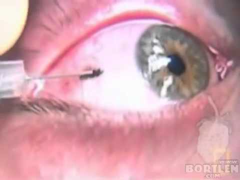 Goz Dovmesi 100 Gercek Eye Tattoo Youtube Youtube