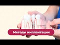 Методы имплантации зубов. Врач стоматолог. Москва