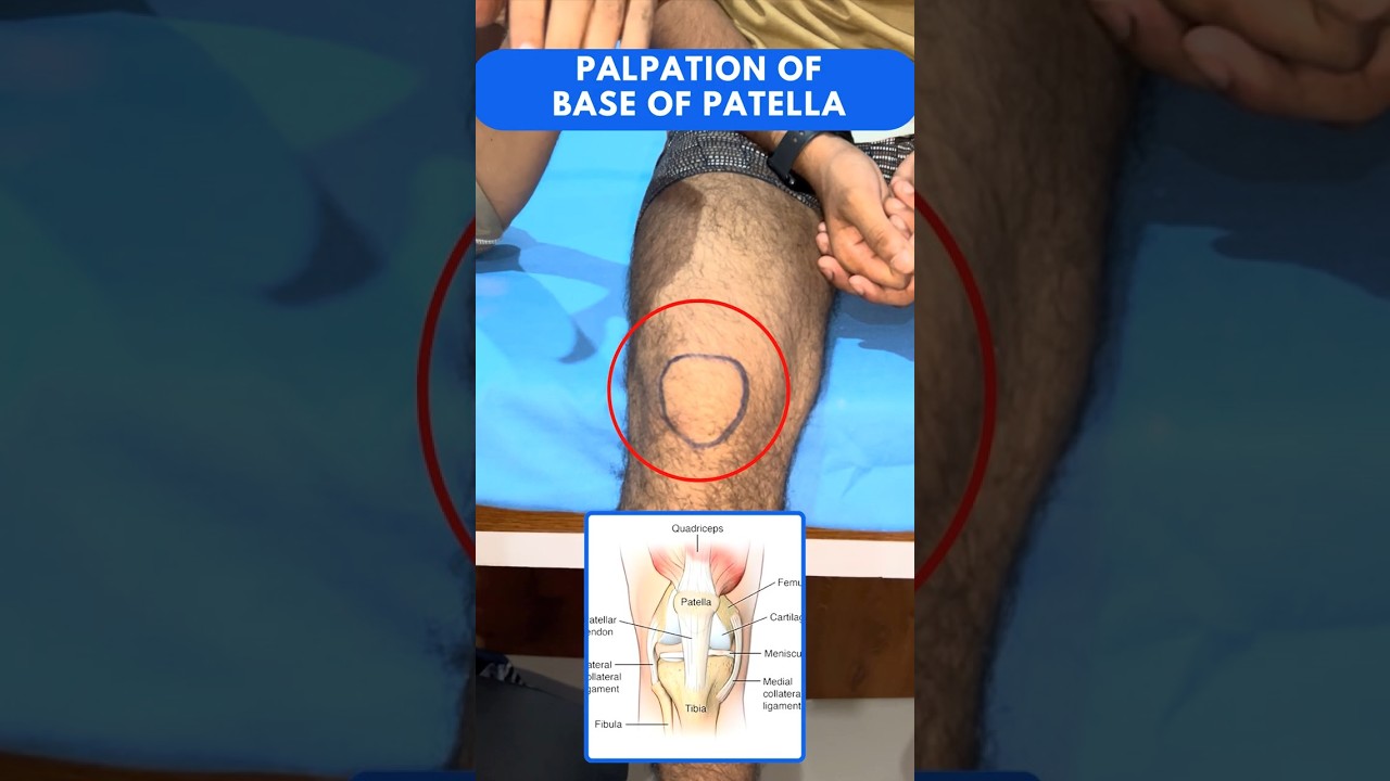 How to Palpate the Base of Patella | Knee Assessment Tutorial