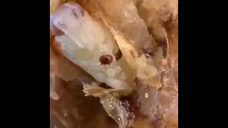 Varroa destructor - el parásito que aniquila a las abejas