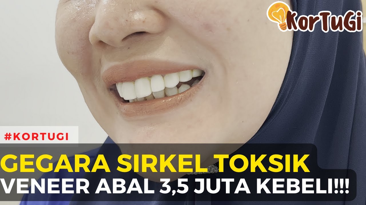 MAKASSAR! Veneer Abal 3,5 Juta Gegara Kemakan Tren Sirkel Toksik!!!  | KorTuGi