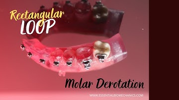 Rectangular_loop_for_molar_derotation | Essential Biomechanics