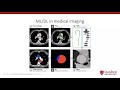 Webinar 31 Preparing medical imaging data for machine learning by Martin Willemink