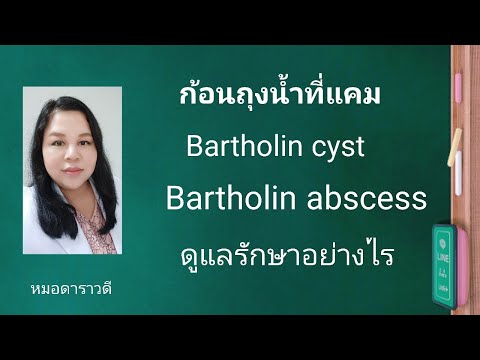 Bartholin cyst , Bartholin abscess คืออะไร ดูแลรักษาอย่างไร by หมอดาราวดี