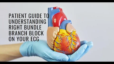 Understanding Right Bundle Branch Block (RBBB) on Your ECG: A Patient Guide.