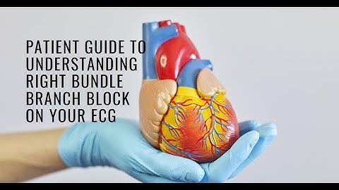 Understanding Right Bundle Branch Block (RBBB) on Your ECG: A Patient Guide.