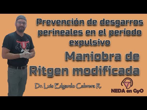 Atención del PARTO (EXPULSIVO) Maniobra de RITGEN Modificada PREVENCIÓN de desgarros perineales