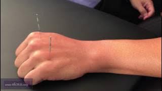 Shangbai (22.03), Zhongbai (22.06), Xiabai (22.07): Master Tung Technique by Chuan-Min Wang