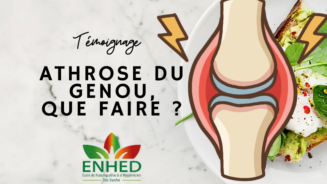 Arthrose du genou, que faire ?